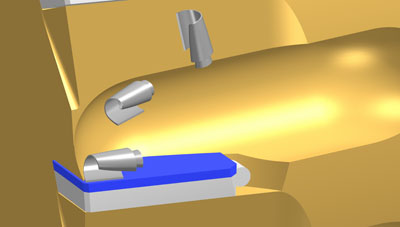 Related image for Lach Diamond Inc.